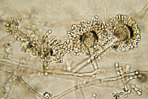 Aspergillus bread mould under a microscope