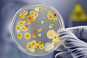 Petri dish with cultures